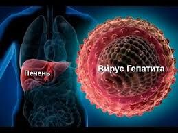 Зараження гепатитом С призводить до хронічного захворювання печінки і може спровокувати цироз або рак печінки, якщо вчасно не почати лікування