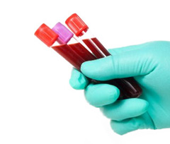 Аналіз крові на ПТГ