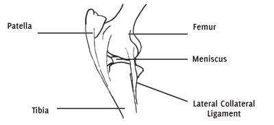 Коліно складається з двох суглобів: найбільший - феморопателлярний суглоб, а два меншого розміру - латеральний і медіальний стегнової-великогомілкової суглоби