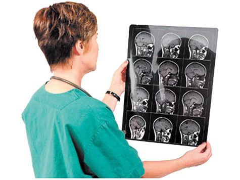 На сьогоднішній день ангіографія судин головного мозку - найпоширеніший метод для діагностики порушень кровообігу головного мозку особливо в діагностично заплутаних випадках, а також перед здійсненням нейрохірургічних операцій