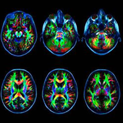 Стан цих органів також обстежується при проведенні МРТ головного мозку