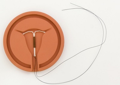 Спіраль Мірена вляется способом гормональної контрацепції - в її склад входить гормон левоноргестрел, який міститься в еластичному циліндрі (стрижні) спіралі і поступово вивільняється з нього з певною швидкістю