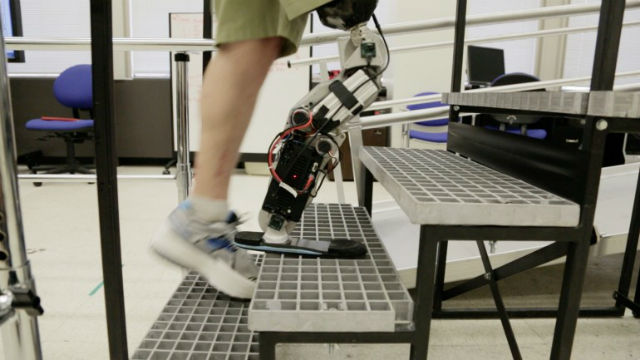 Медики з Чикаго придумали спосіб зберегти сенсорні нерви біля ампутованою ноги і навчили пацієнта керувати протезом ноги однієї лише силою думки