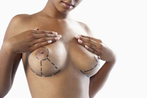 Красиві жіночі груди - поняття неоднозначне