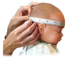Лікування в подібних випадках дуже просте - розчин магнезії, приготований в аптеці за рецептом, поставить очі дитини на місце за 1 місяць, а, отже, нормалізує внутрішньочерепний тиск і допоможе уникнути наслідків надалі