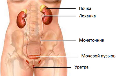 Біль у правому боці на рівні талії може бути нирковою колькою, що може бути причиною сечокам'яної хвороби, перегину сечоводу або запалення