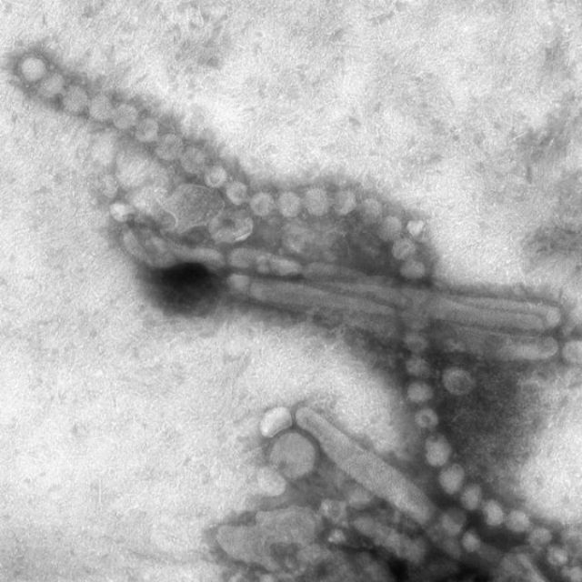 Вчені запропонували радикальний метод боротьби: створити новий, більш потужний штам пташиного грипу для вивчення його впливу на організм, способів поширення та інших властивостей