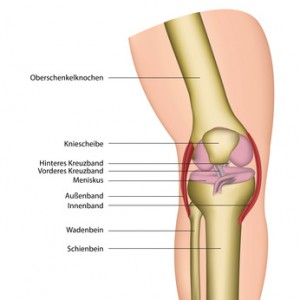 Розрив бічних зв'язок колінного суглоба є поширену спортивну травму, діагностикою та лікуванням якої займається лікар-ортопед