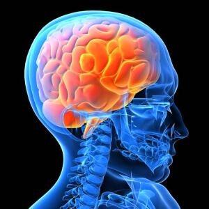 Склероз судин головного мозку - захворювання, яке часто виникає у людей і нерідко провокує смерть