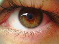 Подивіться добірку ефективних методів лікування   діабетичної ретинопатії   очей