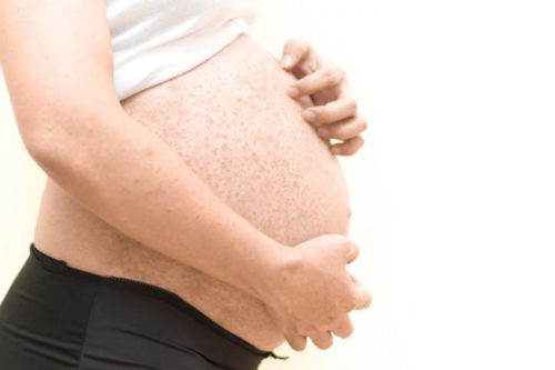 Вірусні інфекції також можуть проявляти себе у вигляді висипки на животі при вагітності