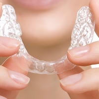 Ортодонтичних апаратів існує безліч, особливо якщо їх перераховувати по авторам