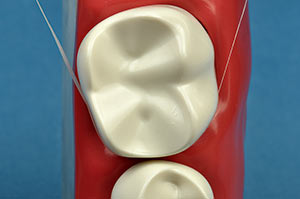 Затем поместите его в промежуток между двумя зубами, более или менее посередине этого промежутка,