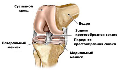 Біль в коліні може бути викликана травмою