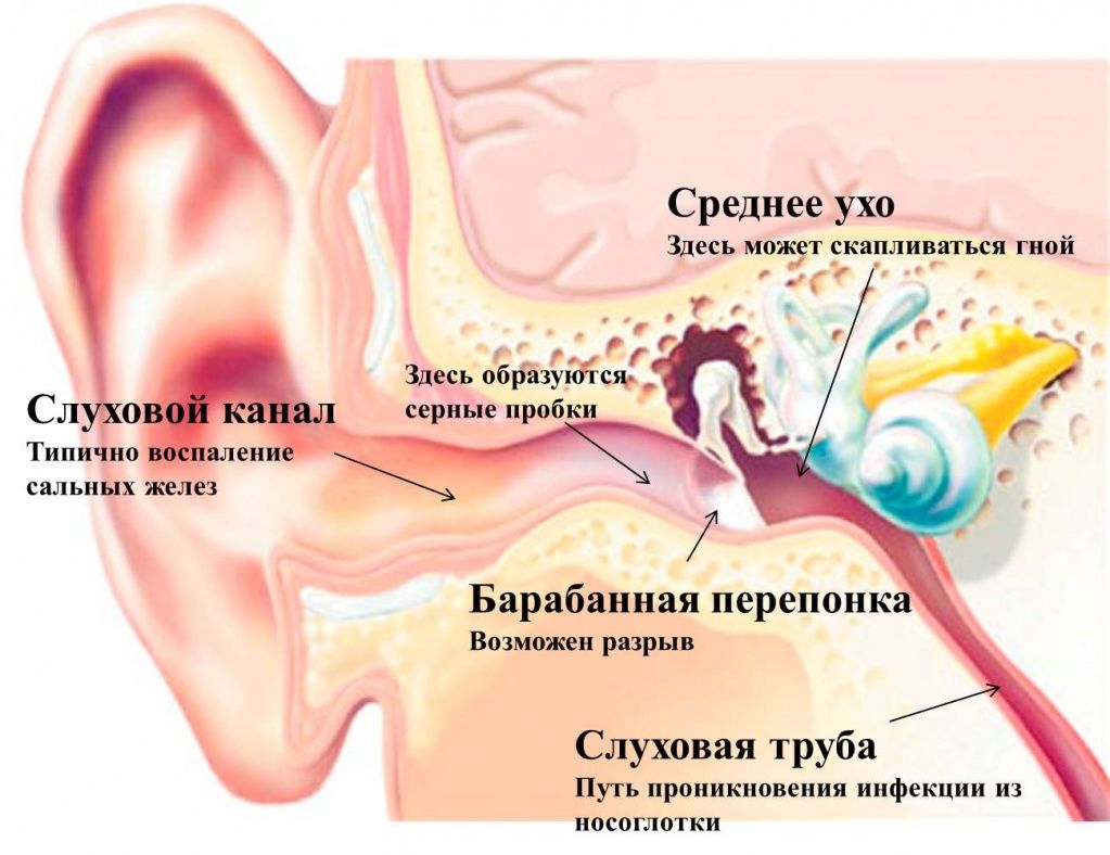Біль у вусі найчастіше пов'язана із запаленням або зовнішнього вуха (вушної раковини і слухового каналу до барабанної перетинки) або середнього вуха (барабанної порожнини безпосередньо за барабанною перетинкою)