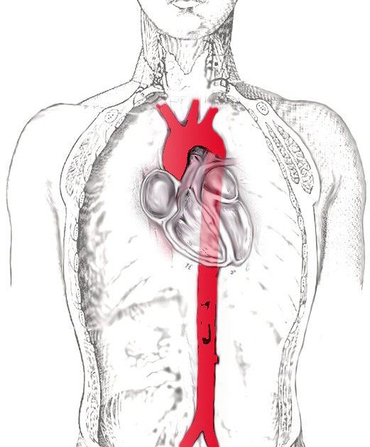 Аорта є головною артерією, що виходить із серця і постачає кров'ю всі органи і тканини нашого організму
