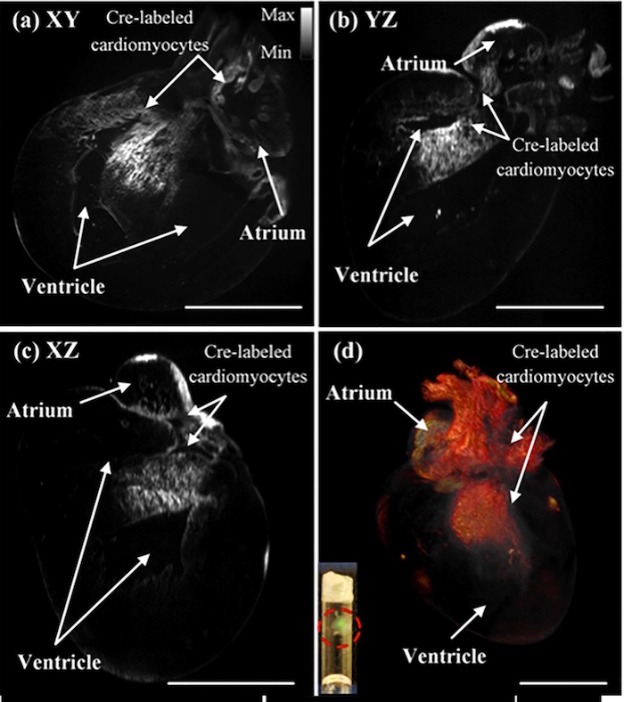 Малюнок 4: Зображення Cre мічених кардіоміоцитів в післяпологовий миші серце з кожної площині