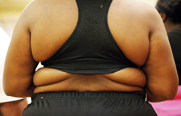 Форуми для жінок і дієтичні клуби вбивають: начитавшись рад по схудненню, американки божеволіють і доводять себе до булімії або анорексії