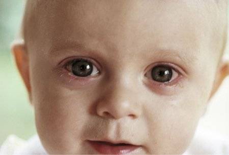 Шкіра малюків дуже чутлива, а в області очей - ще більш сприйнятлива до всього