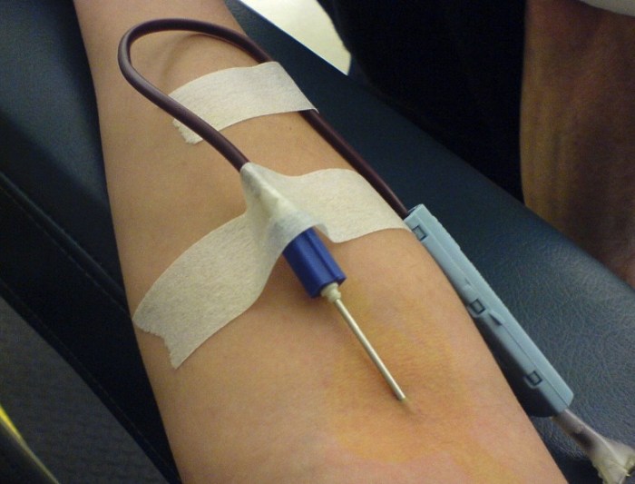 Хоча донорство крові може бути життєво важливим для людини, які наслідки для тих, хто здає кров