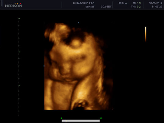 Вартість узі при вагітності в 3 триместрі (з 27 по 40 тиждень) становить 650 гривень