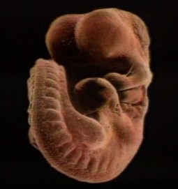 Уже зараз можна уявити, де буде головка, де ніжки, де ручки, де спинка у