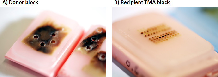 Малюнок 1) 'донор' блок
