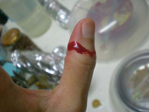 При поверхневому пошкодженні шкіри кров, як правило, швидко зупиняється сама