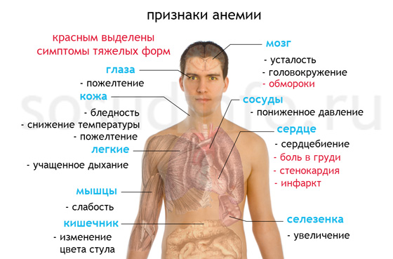 Часті головні болі