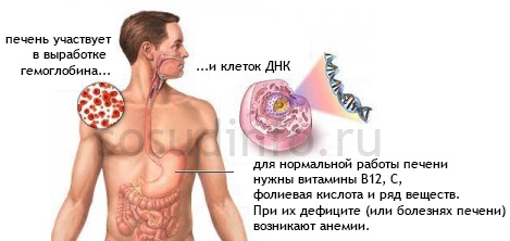 Також спровокувати цю анемію можуть поліпи або рак шлунка, кишкові патології і паразити, гепатити та цироз печінки