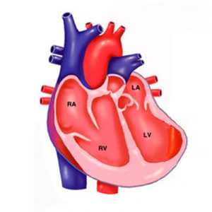 Аневризма лівого шлуночка: причини, симптоми, діагностика, лікування, прогноз