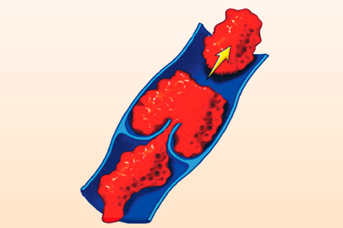 Особливо згубно впливають на організм алкогольні напої, медикаменти на наркотичної основі і сигарети