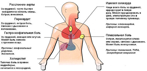 У зв'язку з тим, що грудина є передньою межею області середостіння, в якому розташовано кілька органів, то больовий синдром може бути обумовлений захворюваннями будь-якого з них