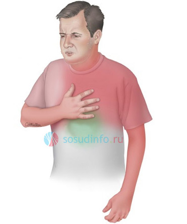 Лікарю необхідно знати безліч нюансів щодо больового синдрому в грудній клітці при різній патології