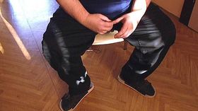 Ілюстративне фото: ЧТ24   «Ми були однією з перших країн в Європі, де кастрація мала чітку правову базу