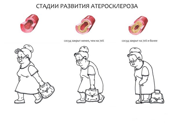 Середній етап розвитку