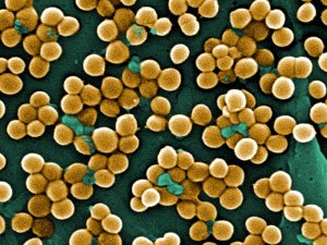 Багато з збудників інфекційних хвороб передаються статевим шляхом, тому, якщо з'явилися світло-коричневі виділення, є сенс перевіритися на наявність бактерій