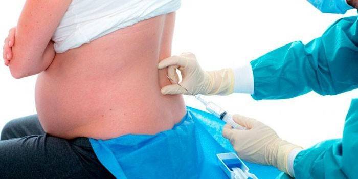 високий тиск у породіллі;   відшарування сітківки;   непродуктивні сутички;   народження недоношеної дитини;   наявність деяких хронічних патологій;   кесарів розтин