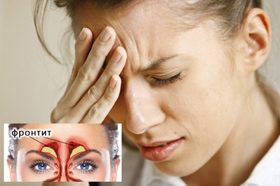 Фронтит або лобовий синусит - запалення фронтального синуса або лобової пазухи, який є частиною передньої основи черепа і сусідить з дуже важливими анатомічними структурами - орбітою і передньої черепної ямкою, що загрожує серйозними ускладненнями фронтіта