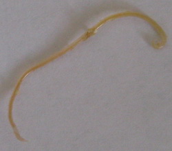 Що таке глисти