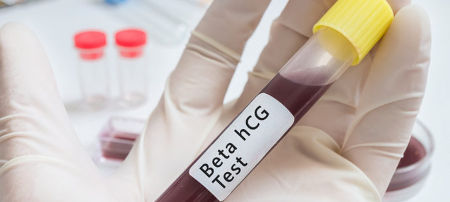 Для інтерпретації результатів важлива динаміка