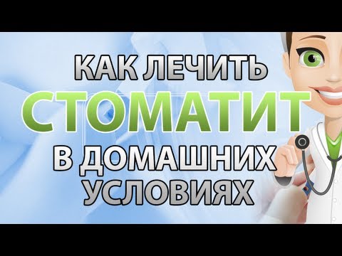 Як лікувати стоматит у домашніх умовах