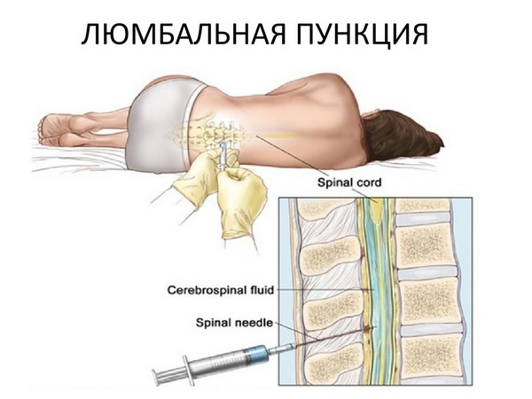 техніка проведення