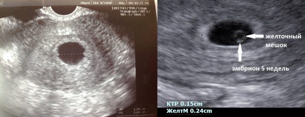 Кожна жінка мріє стати мамою