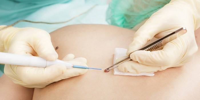 м'язові, суглобові болі; збільшення, зниження маси тіла; порушення роботи шлунково-кишкового тракту, наприклад, метеоризм, синдром подразненого кишечника, діарея, запори; алергічні реакції на шкірі; дисбактеріоз кишечника, дискомфорт; скрегіт уві сні зубами (бруксизм); запалення дихальних шляхів; порушення психіки (прояв згубної дії токсинів, які виділяють паразити); анемія; онкологічне захворювання; збої у функціонуванні імунної системи