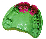 Потім стоматолога потрібно отримати копію вашого рота