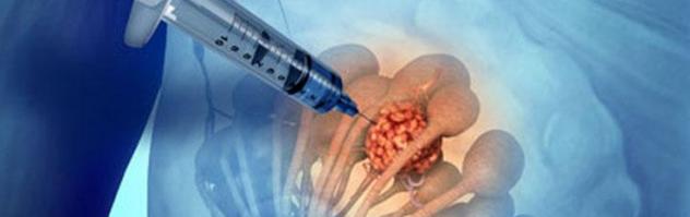 Відповідно, за 10 днів до процедури їх необхідно виключити