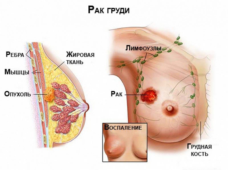 особливості діагностики