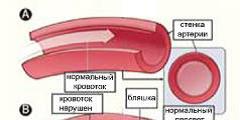 Причини розвитку серцевої недостатності