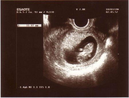 Всі ці причини можуть викликати негативні наслідки